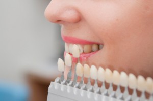 veneers dentist near you